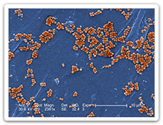 Methicillin-Resistant Staphylococcus aureus (MRSA)