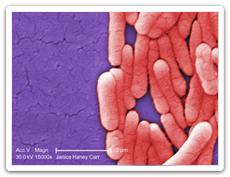 Salmonella (Salmonellosis)